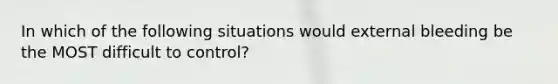 In which of the following situations would external bleeding be the MOST difficult to control?