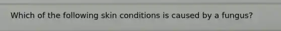 Which of the following skin conditions is caused by a fungus?