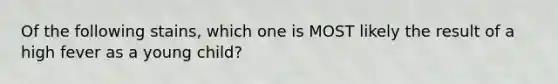 Of the following stains, which one is MOST likely the result of a high fever as a young child?