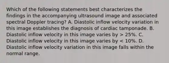 Which of the following statements best characterizes the findings in the accompanying ultrasound image and associated spectral Doppler tracing? A. Diastolic inflow velocity variation in this image establishes the diagnosis of cardiac tamponade. B. Diastolic inflow velocity in this image varies by > 25%. C. Diastolic inflow velocity in this image varies by < 10%. D. Diastolic inflow velocity variation in this image falls within the normal range.