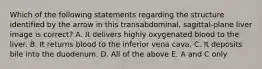 Which of the following statements regarding the structure identified by the arrow in this transabdominal, sagittal-plane liver image is correct? A. It delivers highly oxygenated blood to the liver. B. It returns blood to the inferior vena cava. C. It deposits bile into the duodenum. D. All of the above E. A and C only