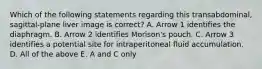 Which of the following statements regarding this transabdominal, sagittal-plane liver image is correct? A. Arrow 1 identifies the diaphragm. B. Arrow 2 identifies Morison's pouch. C. Arrow 3 identifies a potential site for intraperitoneal fluid accumulation. D. All of the above E. A and C only