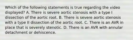 Which of the following statements is true regarding the video displayed? A. There is severe aortic stenosis with a type I dissection of the aortic root. B. There is severe aortic stenosis with a type II dissection of the aortic root. C. There is an AVR in place that is severely stenotic. D. There is an AVR with annular detachment or dehiscence.