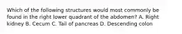 Which of the following structures would most commonly be found in the right lower quadrant of the abdomen? A. Right kidney B. Cecum C. Tail of pancreas D. Descending colon