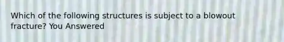 Which of the following structures is subject to a blowout fracture? You Answered