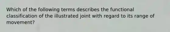 Which of the following terms describes the functional classification of the illustrated joint with regard to its range of movement?