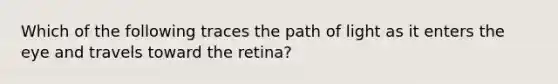 Which of the following traces the path of light as it enters the eye and travels toward the retina?