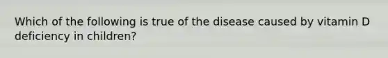 Which of the following is true of the disease caused by vitamin D deficiency in children?