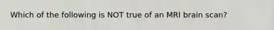 Which of the following is NOT true of an MRI brain scan?