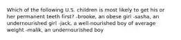 Which of the following U.S. children is most likely to get his or her permanent teeth first? -brooke, an obese girl -sasha, an undernourished girl -jack, a well-nourished boy of average weight -malik, an undernourished boy