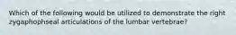 Which of the following would be utilized to demonstrate the right zygaphophseal articulations of the lumbar vertebrae?