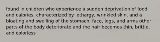 found in children who experience a sudden deprivation of food and calories. characterized by lethargy, wrinkled skin, and a bloating and swelling of the stomach, face, legs, and arms other parts of the body deteriorate and the hair becomes thin, brittle, and colorless