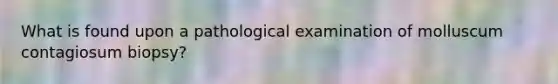 What is found upon a pathological examination of molluscum contagiosum biopsy?