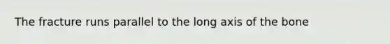 The fracture runs parallel to the long axis of the bone