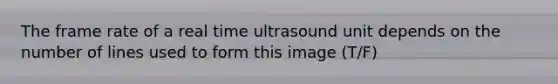 The frame rate of a real time ultrasound unit depends on the number of lines used to form this image (T/F)