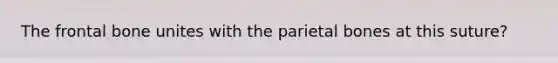 The frontal bone unites with the parietal bones at this suture?