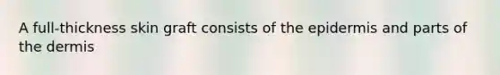 A full-thickness skin graft consists of <a href='https://www.questionai.com/knowledge/kBFgQMpq6s-the-epidermis' class='anchor-knowledge'>the epidermis</a> and parts of <a href='https://www.questionai.com/knowledge/kEsXbG6AwS-the-dermis' class='anchor-knowledge'>the dermis</a>