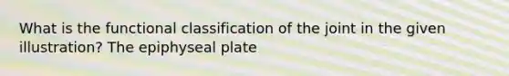 What is the functional classification of the joint in the given illustration? The epiphyseal plate