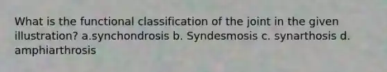 What is the functional classification of the joint in the given illustration? a.synchondrosis b. Syndesmosis c. synarthosis d. amphiarthrosis