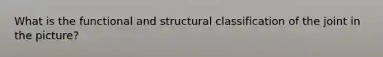 What is the functional and structural classification of the joint in the picture?