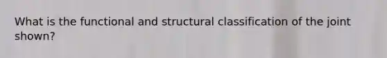 What is the functional and structural classification of the joint shown?