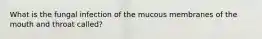 What is the fungal infection of the mucous membranes of the mouth and throat called?