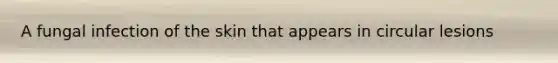 A fungal infection of the skin that appears in circular lesions