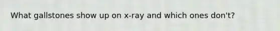 What gallstones show up on x-ray and which ones don't?