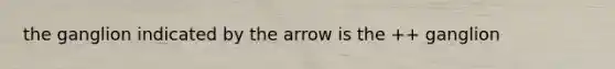 the ganglion indicated by the arrow is the ++ ganglion