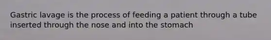 Gastric lavage is the process of feeding a patient through a tube inserted through the nose and into the stomach