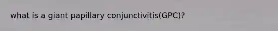 what is a giant papillary conjunctivitis(GPC)?