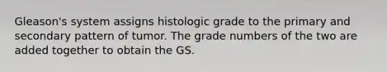 Gleason's system assigns histologic grade to the primary and secondary pattern of tumor. The grade numbers of the two are added together to obtain the GS.