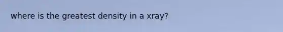 where is the greatest density in a xray?