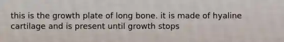 this is the growth plate of long bone. it is made of hyaline cartilage and is present until growth stops