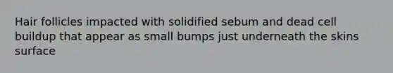 Hair follicles impacted with solidified sebum and dead cell buildup that appear as small bumps just underneath the skins surface