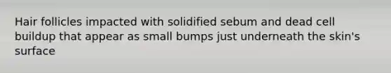 Hair follicles impacted with solidified sebum and dead cell buildup that appear as small bumps just underneath the skin's surface