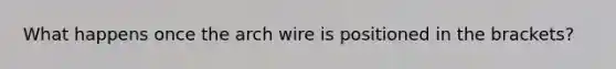 What happens once the arch wire is positioned in the brackets?