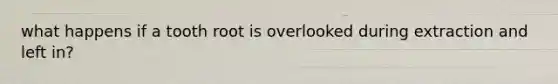 what happens if a tooth root is overlooked during extraction and left in?