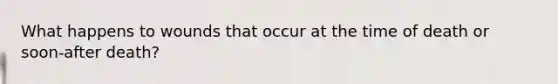 What happens to wounds that occur at the time of death or soon-after death?