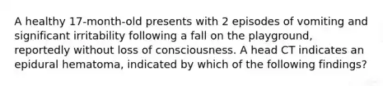 A healthy 17-month-old presents with 2 episodes of vomiting and significant irritability following a fall on the playground, reportedly without loss of consciousness. A head CT indicates an epidural hematoma, indicated by which of the following findings?