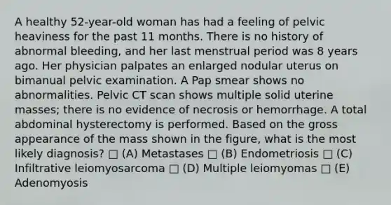 A healthy 52-year-old woman has had a feeling of pelvic heaviness for the past 11 months. There is no history of abnormal bleeding, and her last menstrual period was 8 years ago. Her physician palpates an enlarged nodular uterus on bimanual pelvic examination. A Pap smear shows no abnormalities. Pelvic CT scan shows multiple solid uterine masses; there is no evidence of necrosis or hemorrhage. A total abdominal hysterectomy is performed. Based on the gross appearance of the mass shown in the figure, what is the most likely diagnosis? □ (A) Metastases □ (B) Endometriosis □ (C) Infiltrative leiomyosarcoma □ (D) Multiple leiomyomas □ (E) Adenomyosis