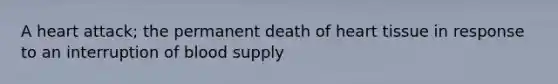 A heart attack; the permanent death of heart tissue in response to an interruption of blood supply