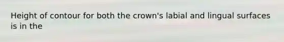 Height of contour for both the crown's labial and lingual surfaces is in the