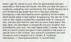 Helen, age 39, comes to your clinic for generalized joint pain especially in the knees and hands. She tells you that the pain is moderate, spreading, and symmetrical. She reports having had a sore throat and low-grade fever for a few days and then developing a rash described as warm erythema of the cheeks, which lasted about 4 days before disappearing. You ask her if the rash on the cheeks included the nasolabial folds or circumoral skin, and she tells that the rash did not cover these areas. Two days later, she developed a nonspecific macular eruption that preceded the joint pain. Her rash faded within 2 weeks, but she tells you that it comes and goes if she's bathed in hot water or spends time in the sunlight. Your patient's symptoms are most consistent with a diagnosis of A. rubella. B. erythema infectiosum. C. rheumatoid arthritis. D. scarlet fever.