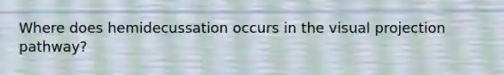 Where does hemidecussation occurs in the visual projection pathway?