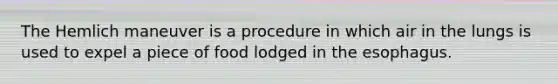 The Hemlich maneuver is a procedure in which air in the lungs is used to expel a piece of food lodged in the esophagus.
