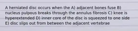 A herniated disc occurs when the A) adjacent bones fuse B) nucleus pulpous breaks through the annulus fibrosis C) knee is hyperextended D) inner core of the disc is squeezed to one side E) disc slips out from between the adjacent vertebrae