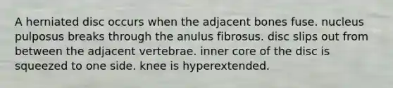 A herniated disc occurs when the adjacent bones fuse. nucleus pulposus breaks through the anulus fibrosus. disc slips out from between the adjacent vertebrae. inner core of the disc is squeezed to one side. knee is hyperextended.