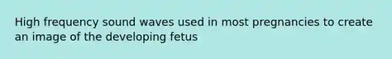 High frequency sound waves used in most pregnancies to create an image of the developing fetus