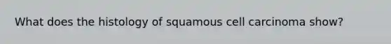 What does the histology of squamous cell carcinoma show?